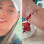 ACIDENTE COM KARINA MENDES